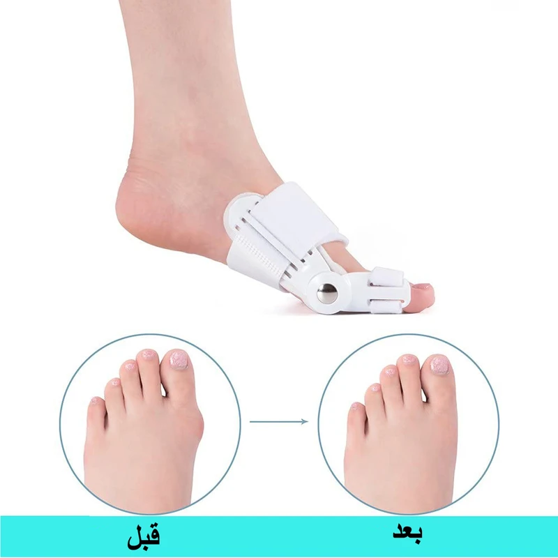 اسپیلنت هالوکس والگوس